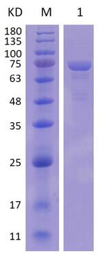 12% SDS-PAGE analysis profiles of purified NTHI0369-22-709 (CBB stained).